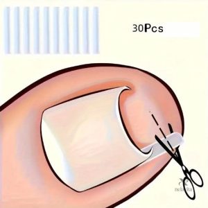 Correcteur d’Ongles Incarnés en Silicone – Clip Redresseur Indolore pour Soulager la Douleur et Corriger la Courbure des Ongles