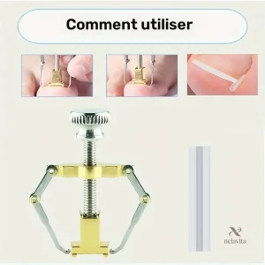 Correcteur d'ongles incarnés pour pédicure efficace