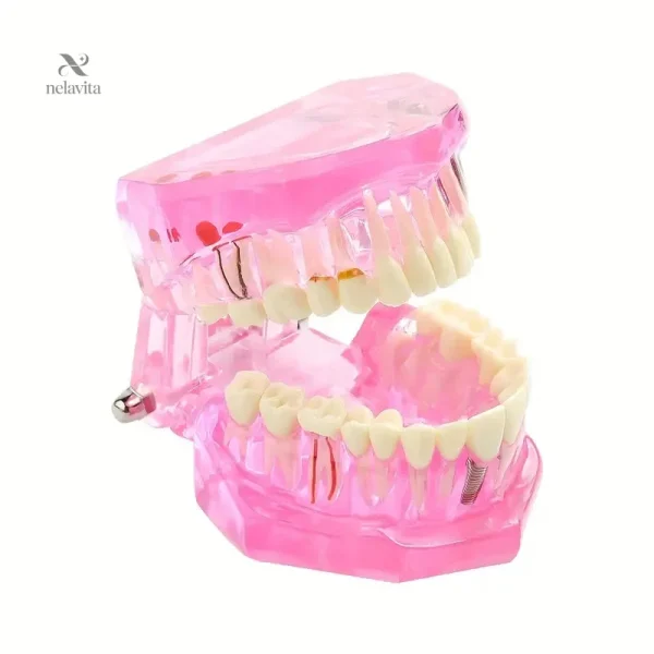 modele-de-machoire-articulee-avec-dents-maquette-anatomiq-wist4d-1