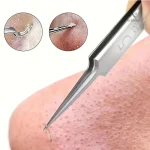 Outil de précision pour éliminer les poils incarnés facilement