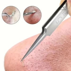 Outil de précision pour éliminer les poils incarnés facilement